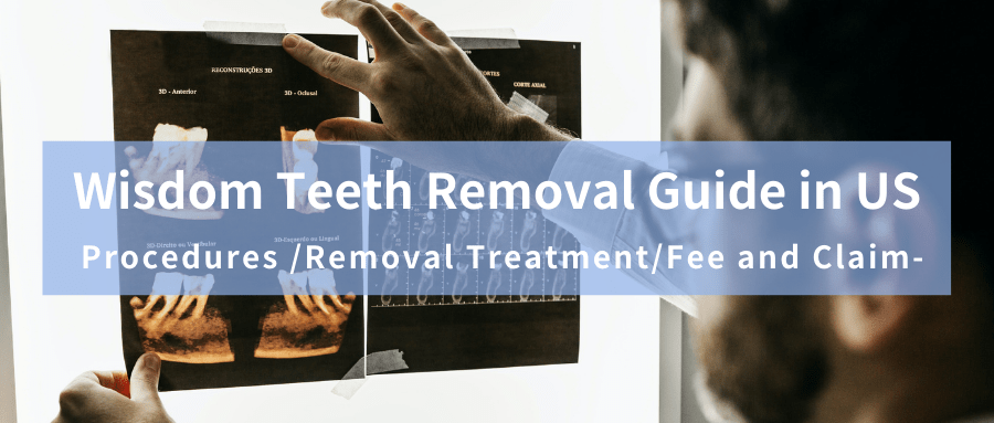 Wisdom Teeth Removal – Procedures & Tips banner