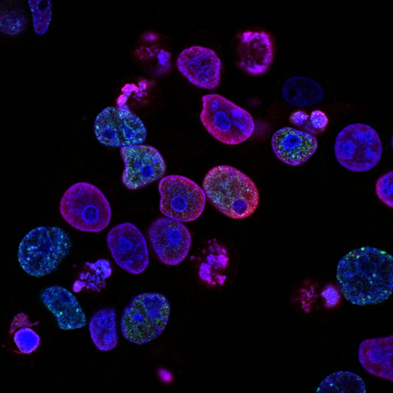 Cancer cells that cannot be Ignored